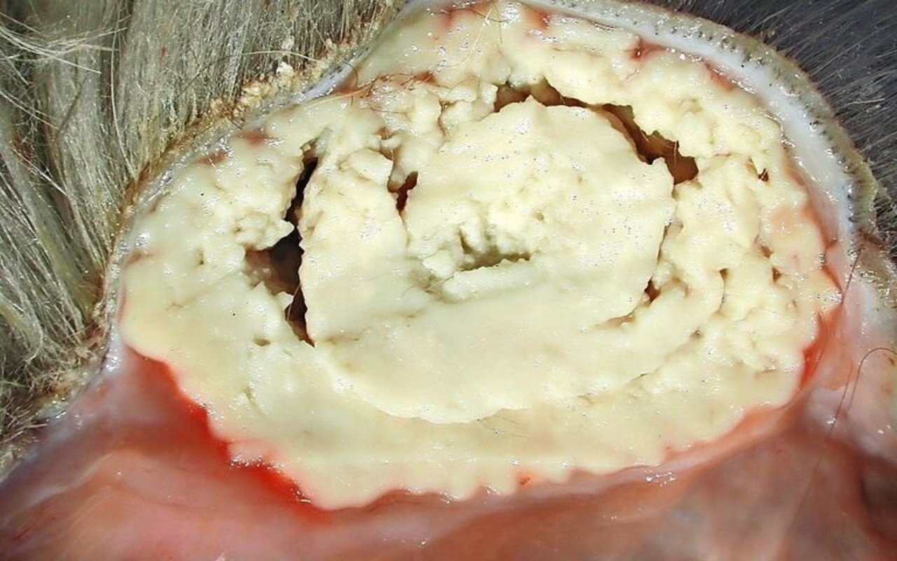 So sieht es im Inneren eines Abszesses aus.